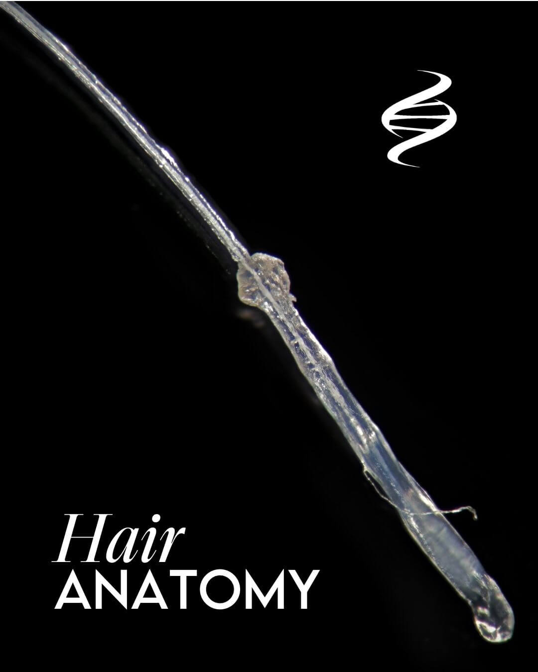 "Hair Anatomy" with a close up magnification of a real hair follicle including the hair shaft