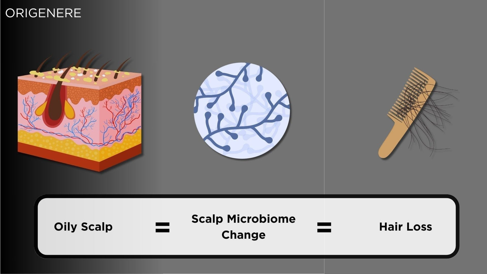 Oily Scalp and Hair Loss: What’s Really Going On?