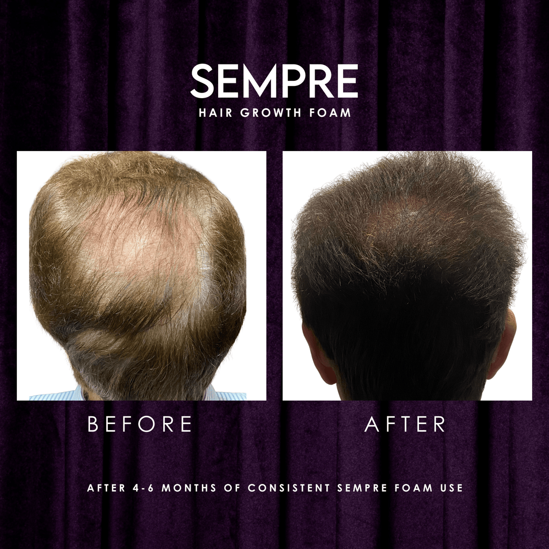Sempre Botanical Blend Before And After 