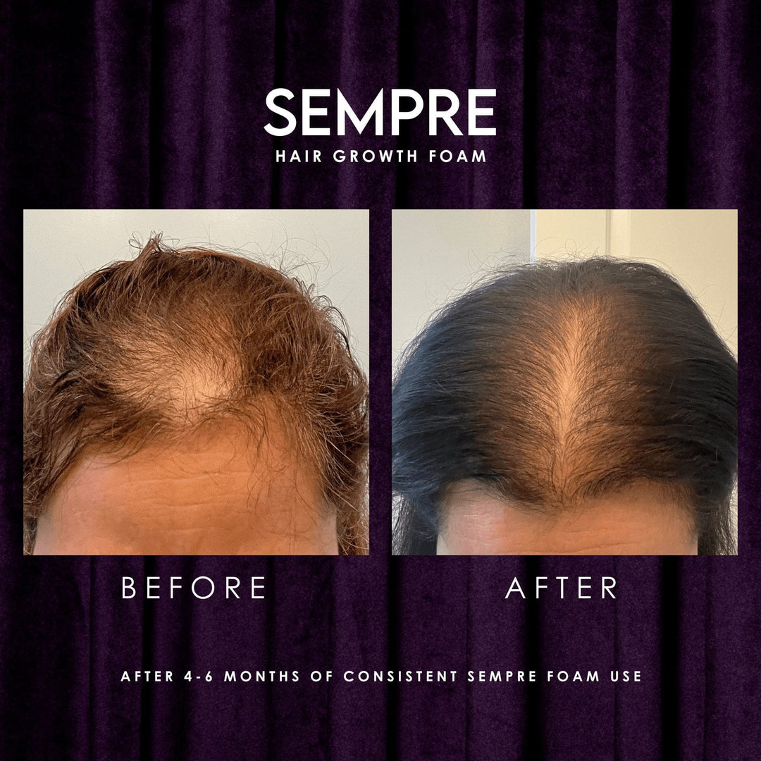 Sempre Growth Foam Before And After Result