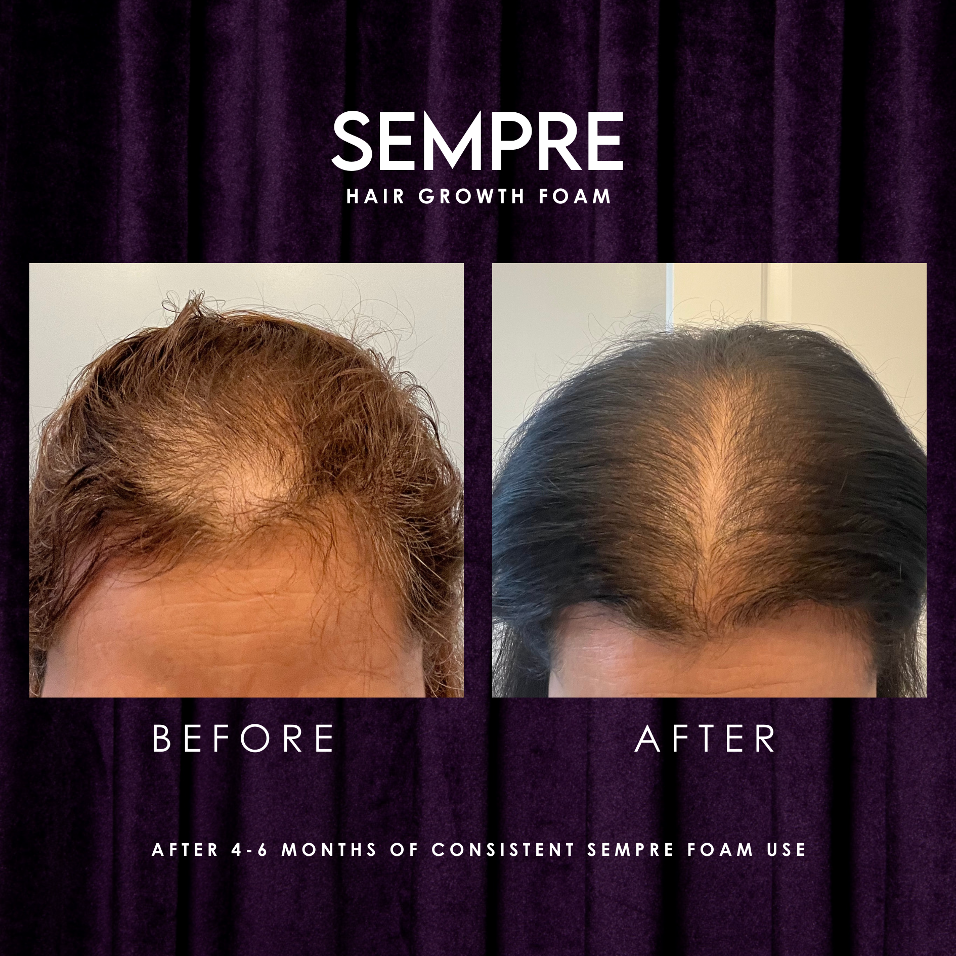 Sempre Growth Foam Before And After Result