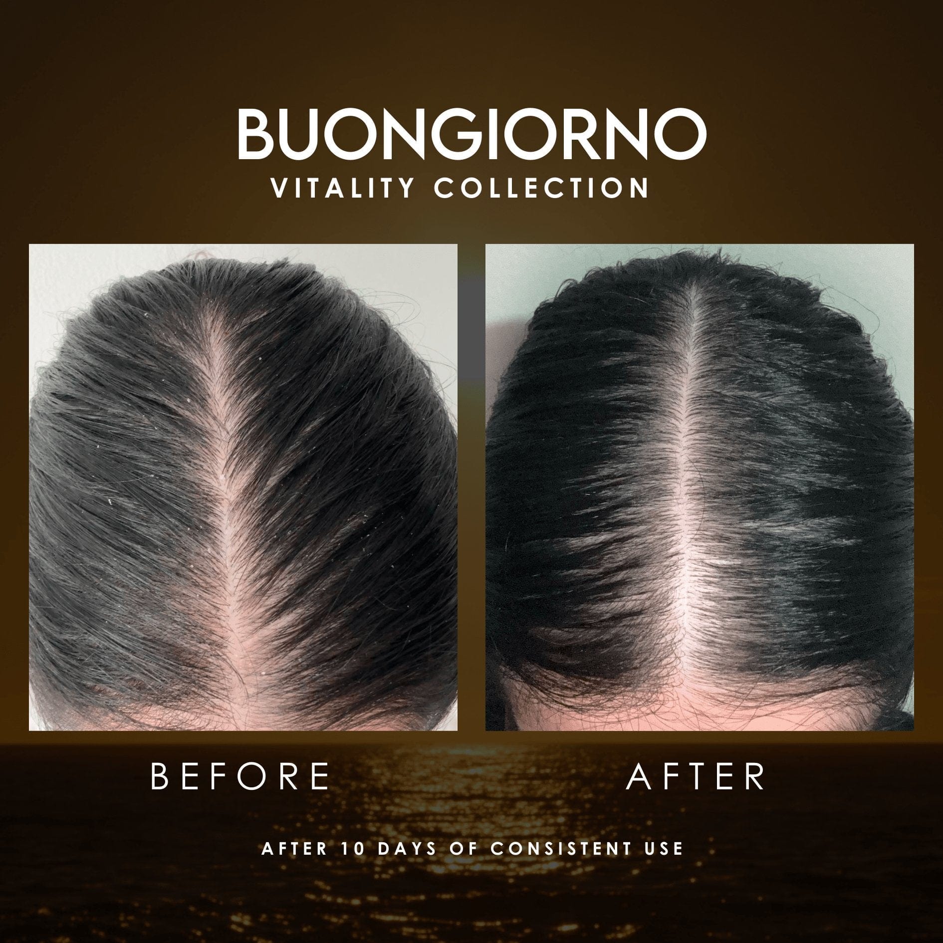 Before And After Improvement of Dandruff With Buongiorno 