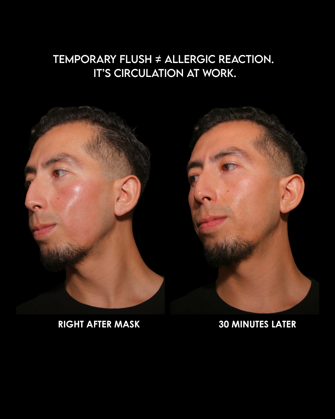 Before and after photo showing the NERO Detoxifying Scalp and Face Mask ginger flush reaction — temporary redness that enhances circulation and skin vitality, revealing a healthy glow 30 minutes later.