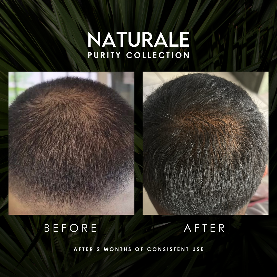 Origenere - Naturale Purity Collection Before And After Results