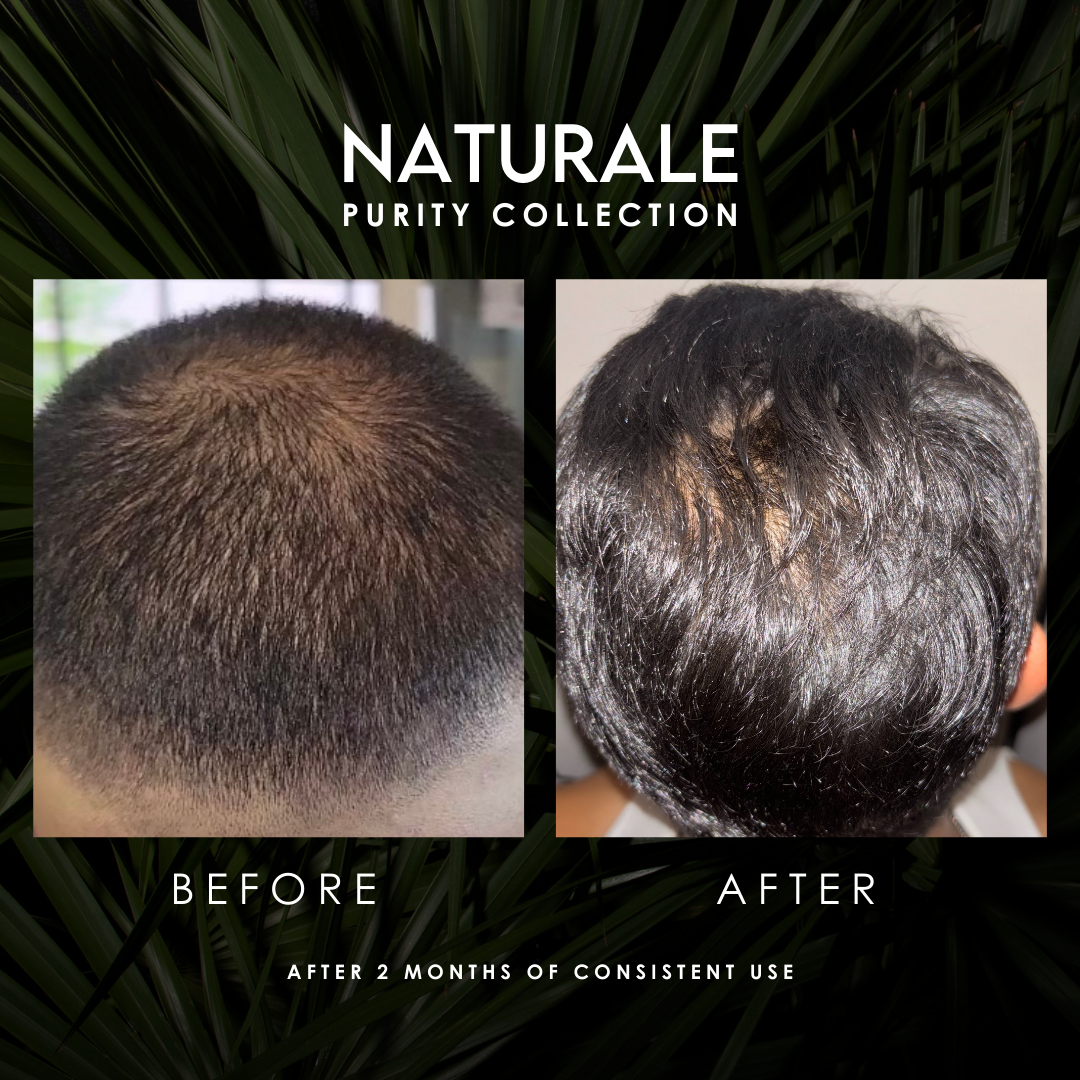 Naturale Purity Collection Results