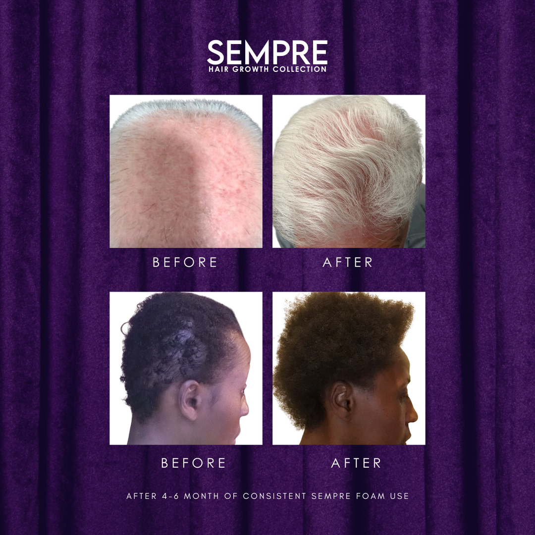 Sempre Foam before and after pictures with visibly thicker hair 