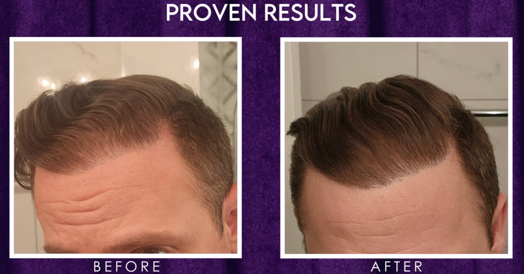 Sempre Hair Growth Foam / Organonutrient Botanical Blend