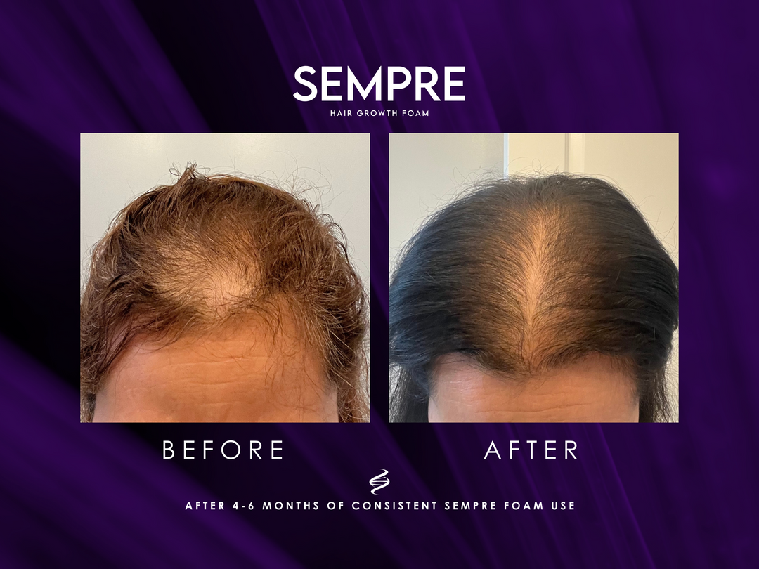 Sempre Hair Growth Gift Set