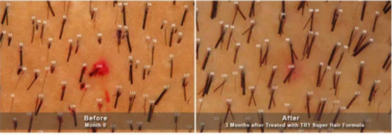 TR6™ Botanical Technology